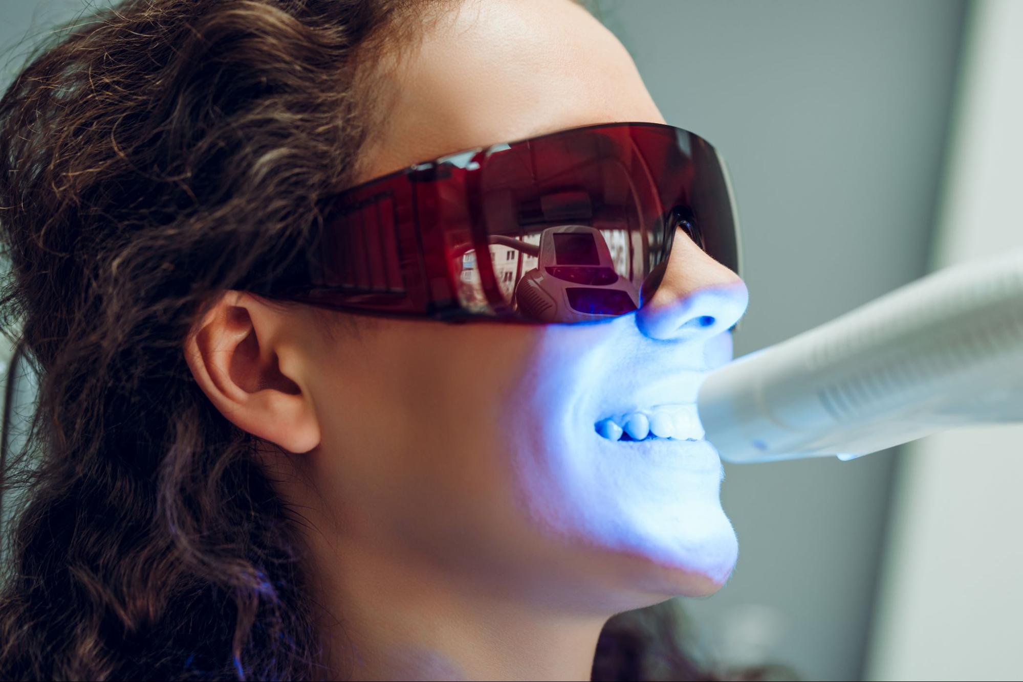 5 Things to Know About Icon White Spot Treatment