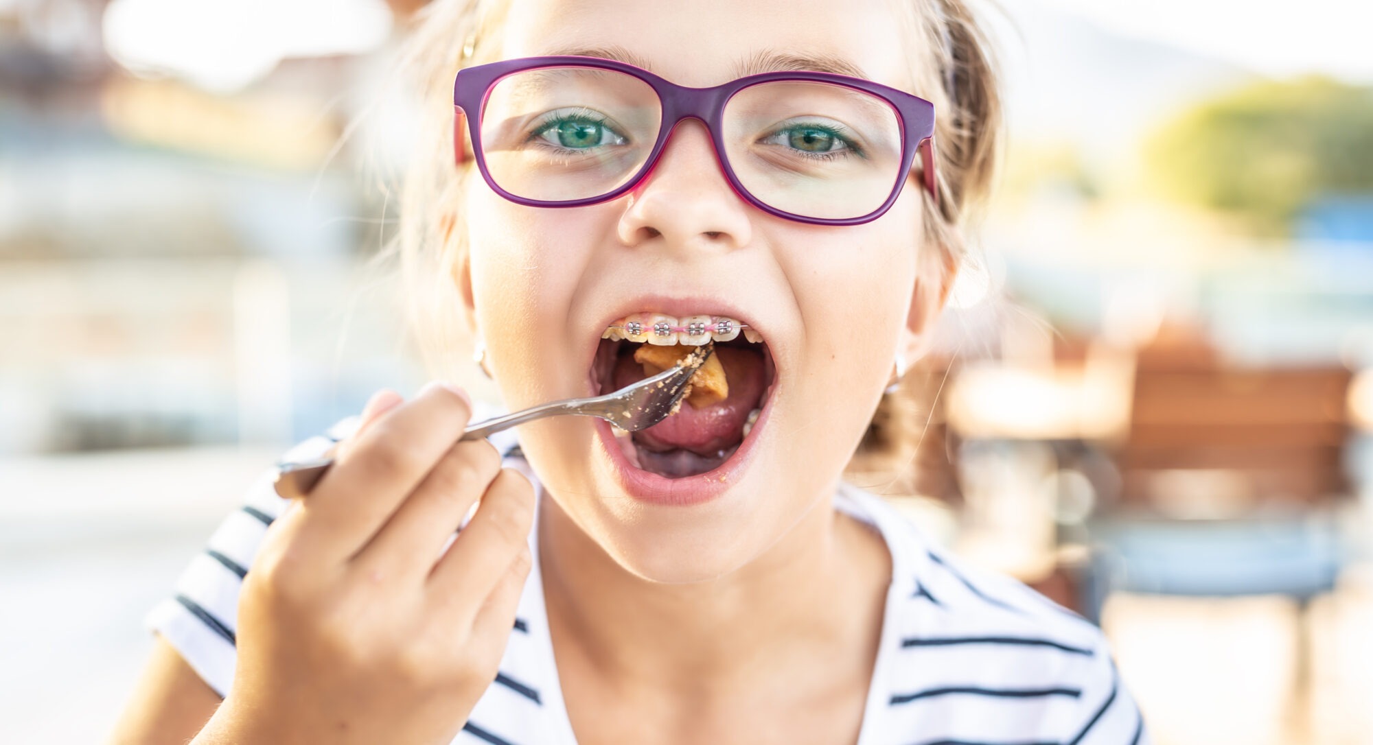 5 Foods To Avoid With Braces In Baytown