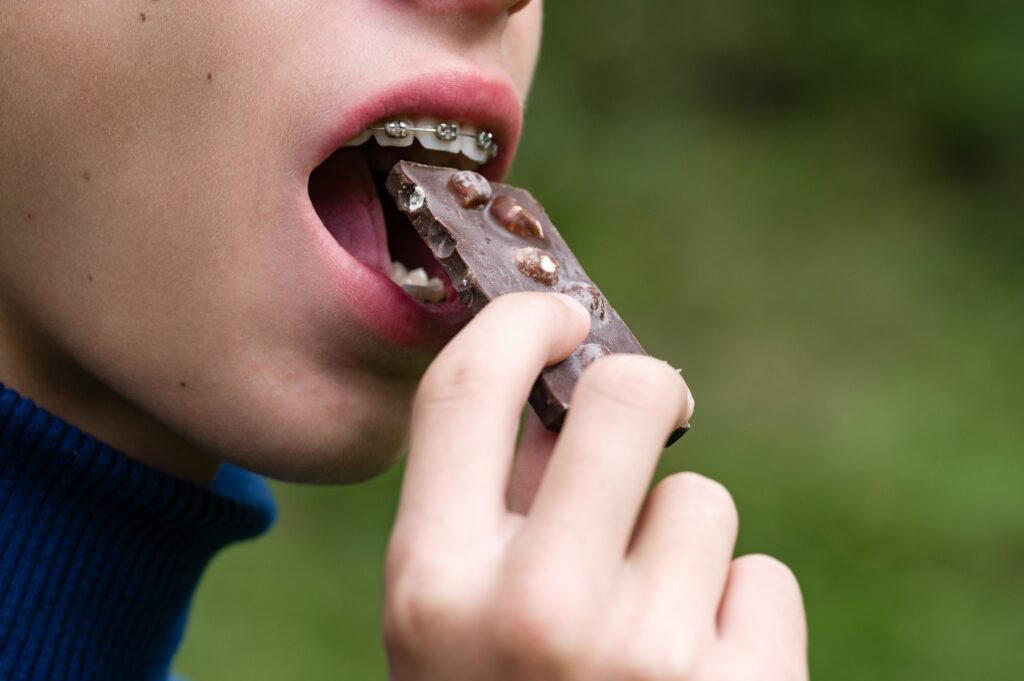 5 Foods To Avoid With Braces In Baytown